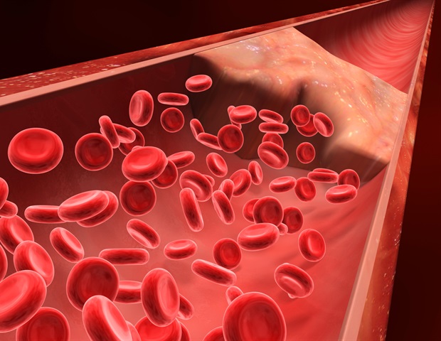 Engineered blood clots form faster to stop severe bleeding