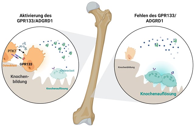 Bone diagram