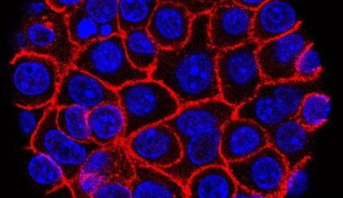 Hope emerges as new pill targets deadly pancreatic cancer