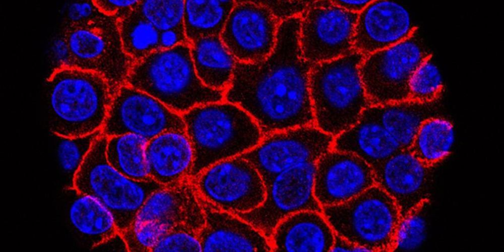 Hope emerges as new pill targets deadly pancreatic cancer