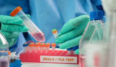 France detects first Ebola case outside Africa in current outbreak