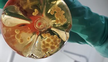 Dr. Brown: The big science behind these lab-grown mini-brains