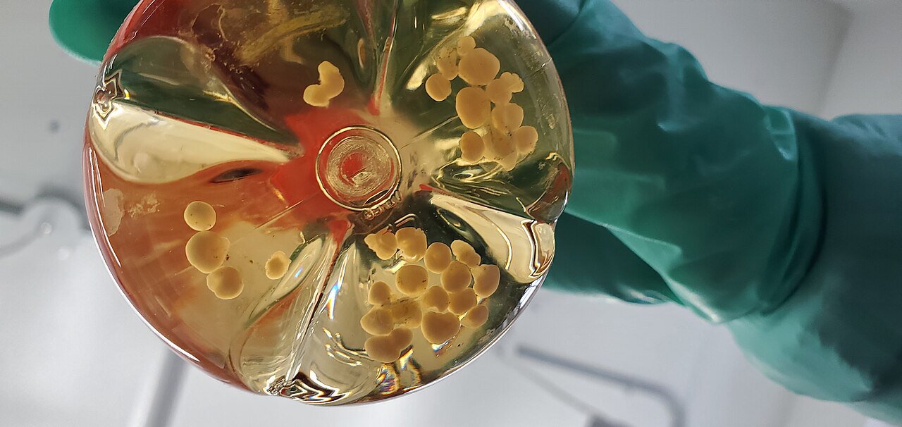 Dr. Brown: The big science behind these lab-grown mini-brains