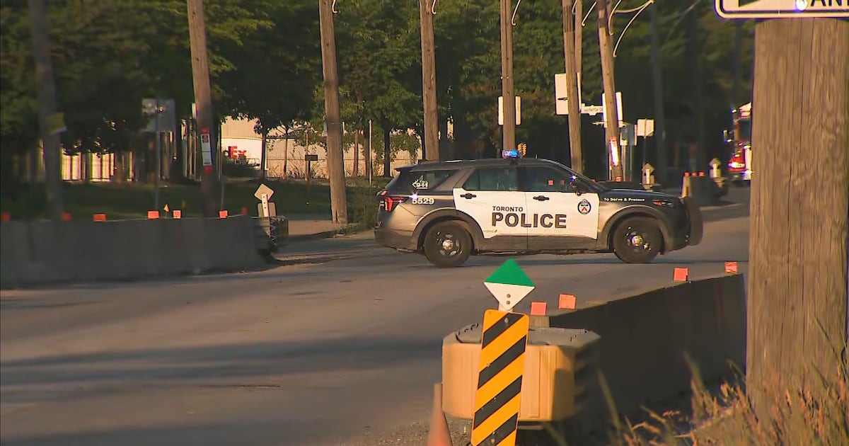 Toronto police investigating pedestrian struck