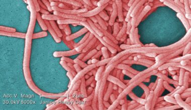 Legionellosis outbreak in Hamilton over, public health officials say