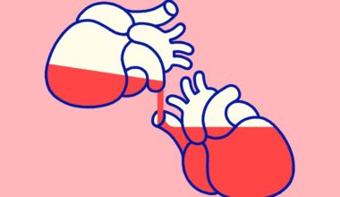 The organ donation boom complicating the boundary between life and death