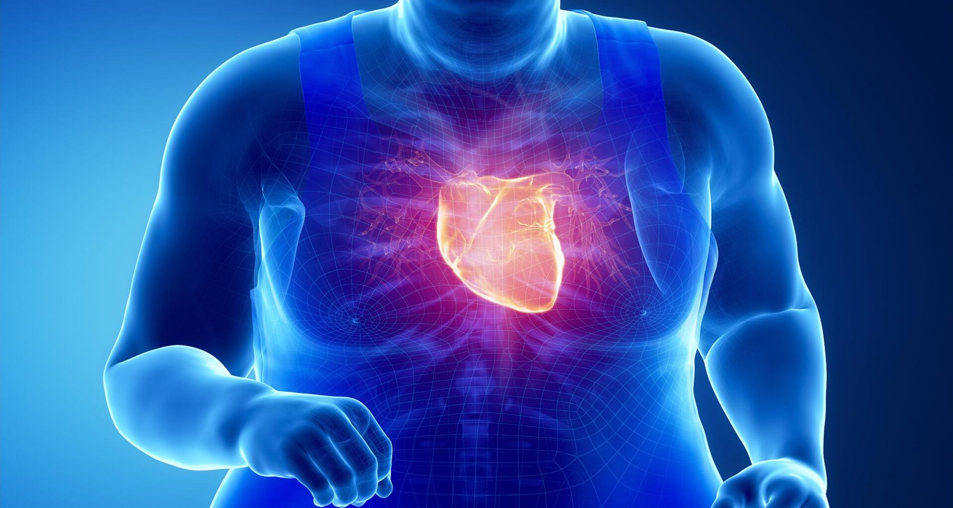 Obese Man Exercise Heart Attack Illustration