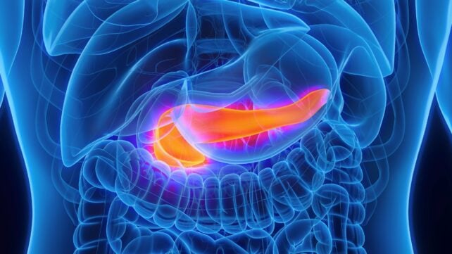 A glowing orange pancreas illustrated inside a human body