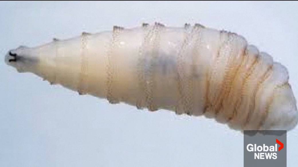 Click to play video: '1st human case of flesh-eating screwworm parasite confirmed in U.S.'