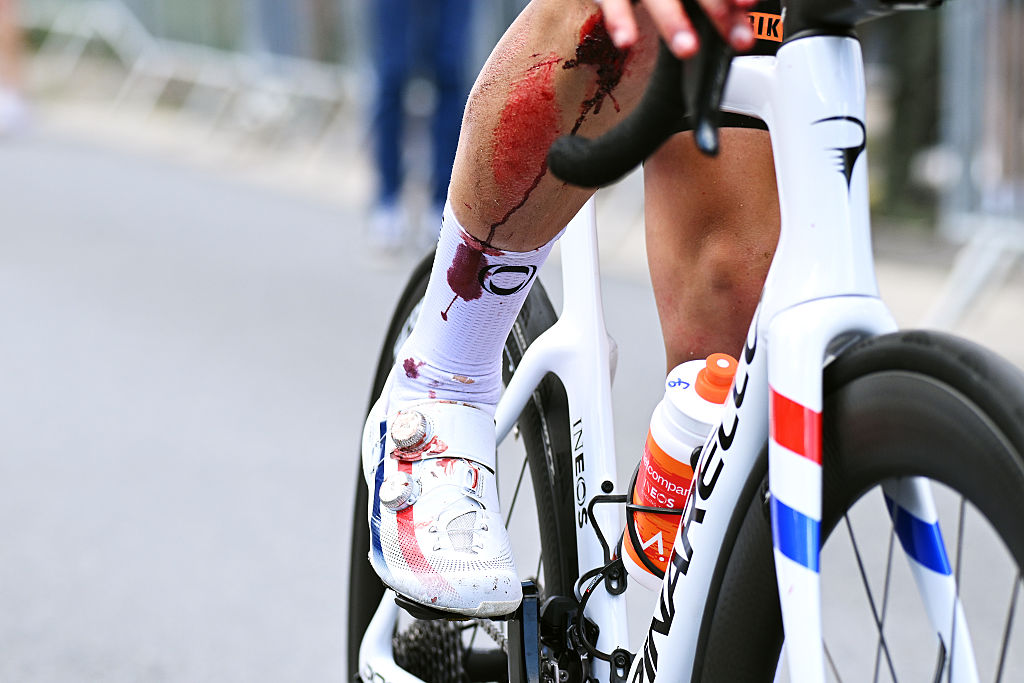 MONTROND-LES-BAINS, FRANCE - JUNE 10: (EDITOR&rsquo;S NOTE: Image contains graphic content.) Detail view of Samuel Watson of Great Britain and Netcompany INEOS Cycling Team injured after the 78th Tour Auvergne-Rhone-Alpes 2026, Stage 4 a 167.4km stage from Le Puy-en-Velay to Montrond-les-Bains / #UCIWT / on June 10, 2026 in Montrond-les-Bains, France. (Photo by Dario Belingheri/Getty Images)