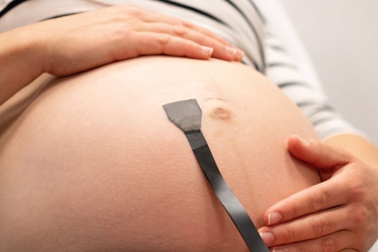 Wearable Ultrasound Patch on Pregnant Stomach