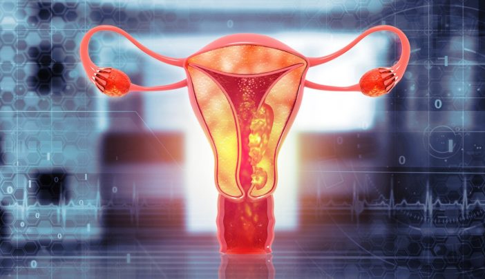 ‘How I knew I had endometrial (uterine) cancer’: Survivors share symptoms 