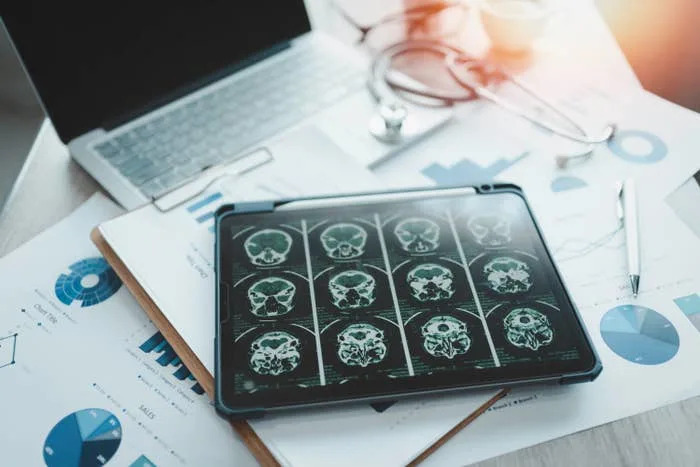 MRI scans on a tablet beside medical charts, a laptop, and a stethoscope on a desk