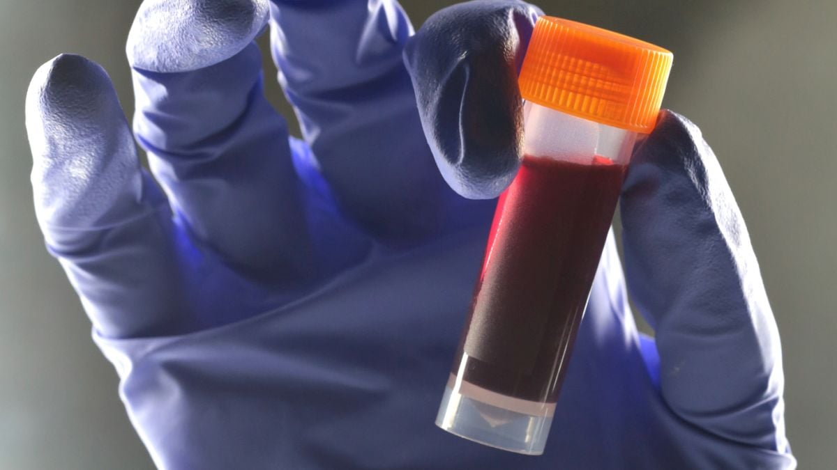 One Blood Type Appears to Carry Higher Risk of Type 2 Diabetes : ScienceAlert