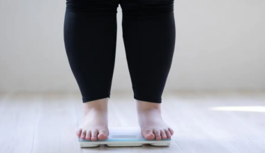 Obesity cases rising fastest in young adults