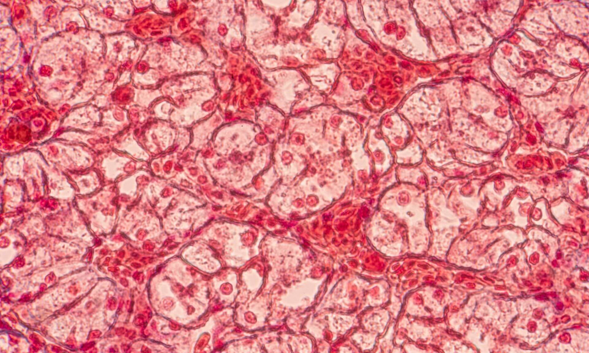 Explaining how skin and other tissues stay strong