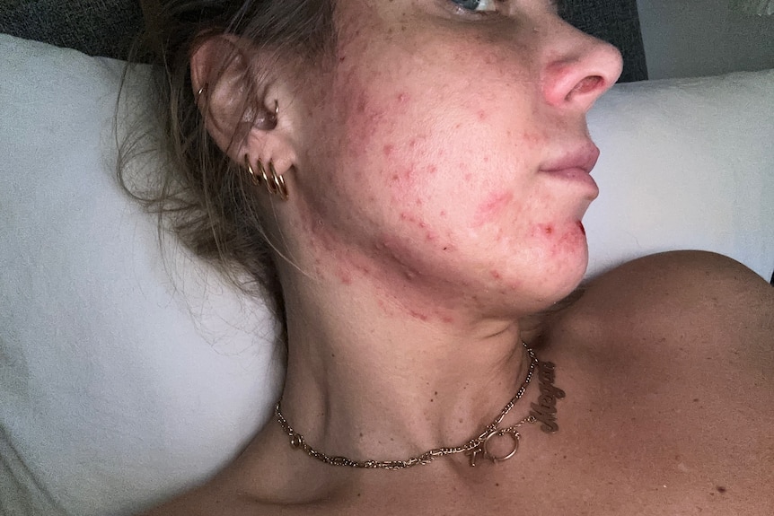 Megan Hancocks skin