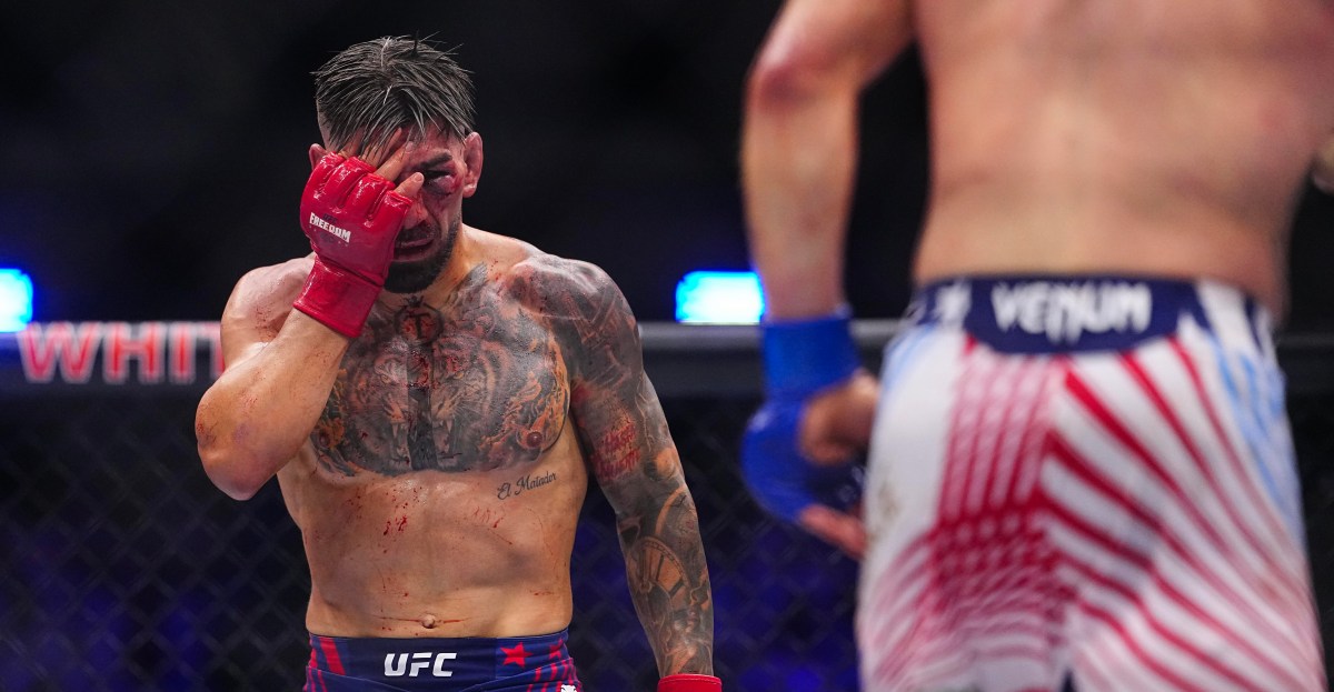 Report: Ilia Topuria injuries revealed following UFC White House loss - MMA Fighting