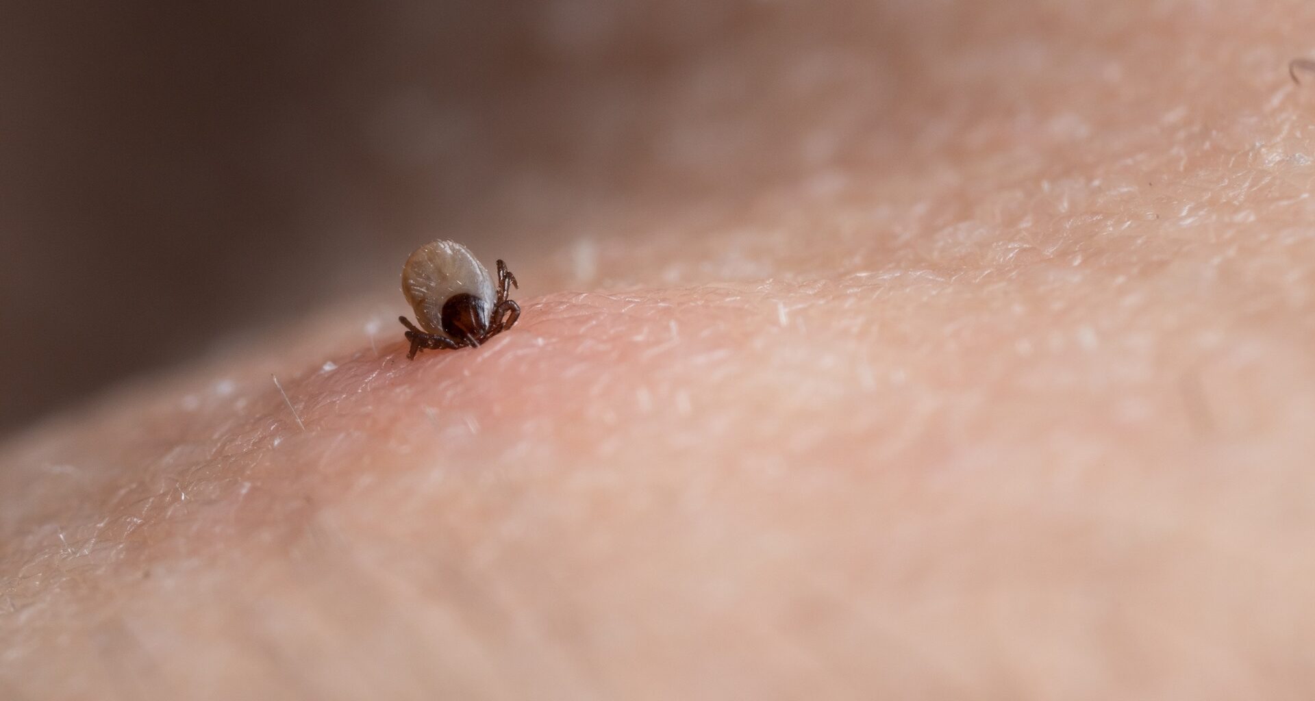 A tick attached to human skin.