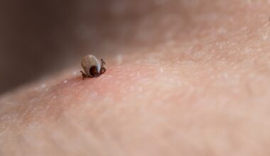A tick attached to human skin.