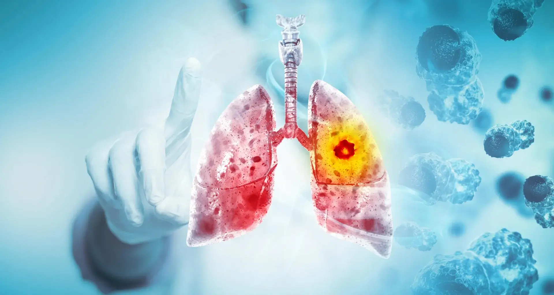Major review finds vaping likely causes lung and oral cancer
