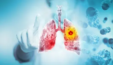 Major review finds vaping likely causes lung and oral cancer