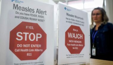 Calgary medical clinic site of potential measles exposure, province says - Calgary