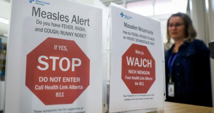 Calgary medical clinic site of potential measles exposure, province says - Calgary