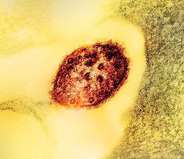 measles virus in red against a yellow background
