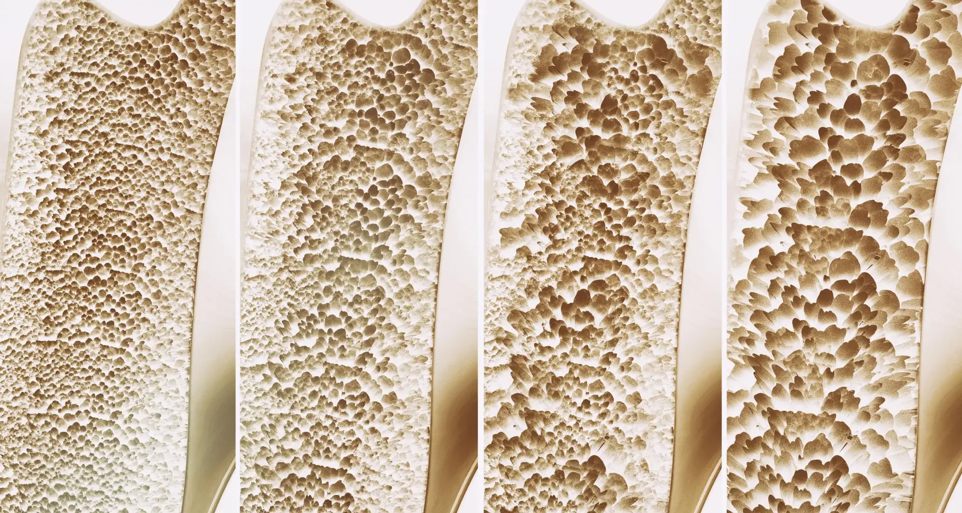 Millions take calcium and vitamin D for stronger bones. A major review finds little benefit
