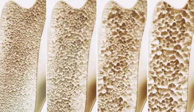 Millions take calcium and vitamin D for stronger bones. A major review finds little benefit