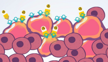 MUHC launches world’s first radioligand therapy trial for HER2-positive cancers