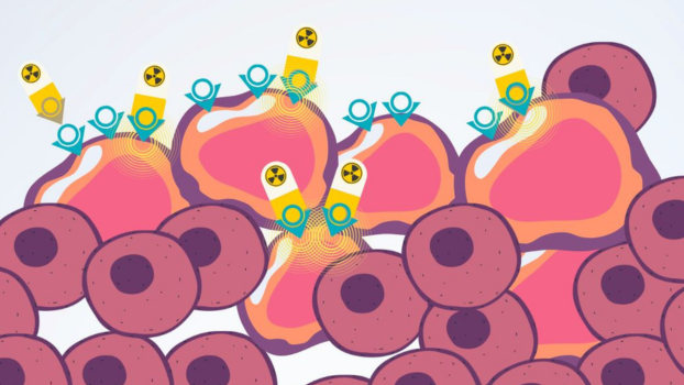 MUHC launches world’s first radioligand therapy trial for HER2-positive cancers