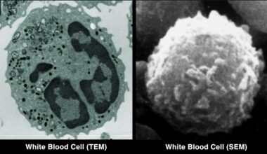 Converting A Scanning Electron Microscope Into A TEM Is Surprisingly Easy