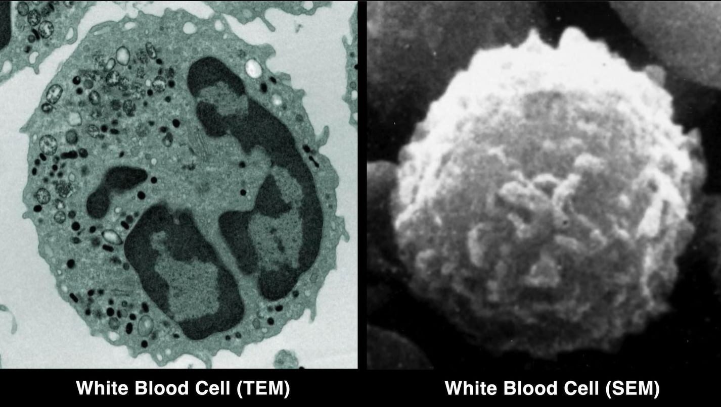 Converting A Scanning Electron Microscope Into A TEM Is Surprisingly Easy
