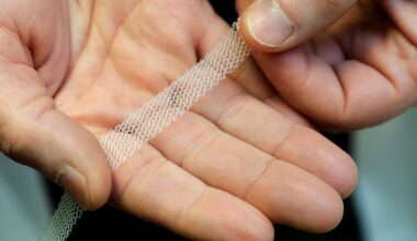Pelvic mesh was among three medical products found to have caused 'avoidable harm' to patients. File pic: AP