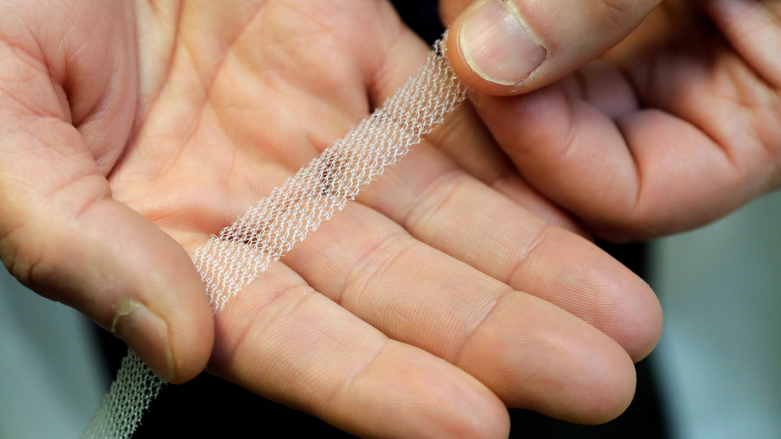 Pelvic mesh was among three medical products found to have caused 'avoidable harm' to patients. File pic: AP