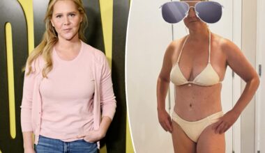 Amy Schumer shows off C-section scar in tiny bikini, boasts that she's a 'Warrior'