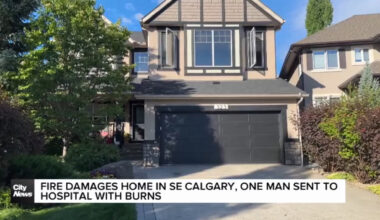 Fire damages home in SE Calgary, one man sent to hospital with burns