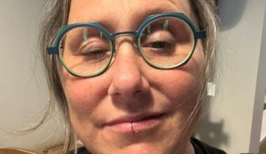 B.C. woman with rare autoimmune condition shares expertise in reimagined chapter of Winnie-the-Pooh