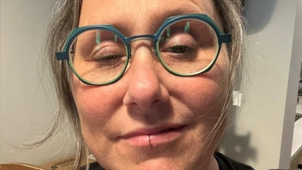 B.C. woman with rare autoimmune condition shares expertise in reimagined chapter of Winnie-the-Pooh