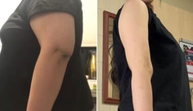 Gym-goer who shed 9st 6lb credits five-move dumbbell routine for arm transformation