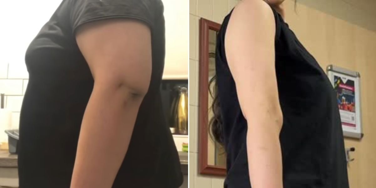 Gym-goer who shed 9st 6lb credits five-move dumbbell routine for arm transformation