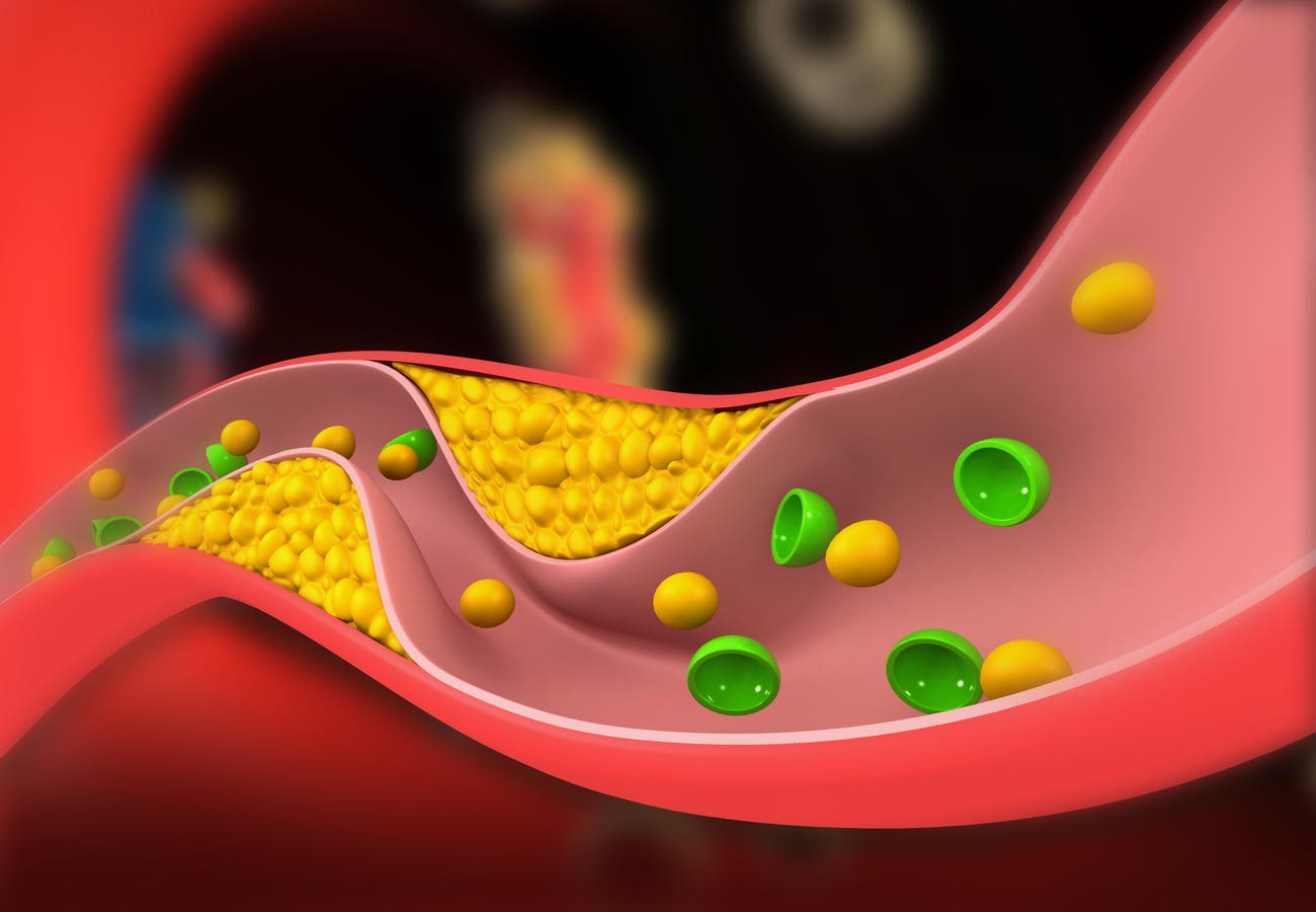 A Novel Pill For Cholesterol: FDA Approves Lipfendra