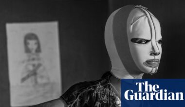 A 12-year-old casualty of war recovers in hospital: Alessio Mamo’s best photograph | Art and design
