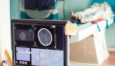 Albertans can pay for MRIs and other tests without a doctor's referral, as of Friday