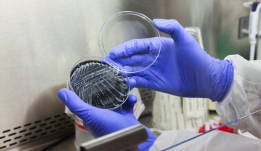 First Patient Dies of Legionnaires’ Disease After New York Outbreak