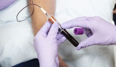 What to know about the powerful new cholesterol pill