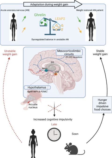 Scientists Find a Hormone Spike Linked to Anorexia Nervosa, Which Could Help Identify Relapse Risk