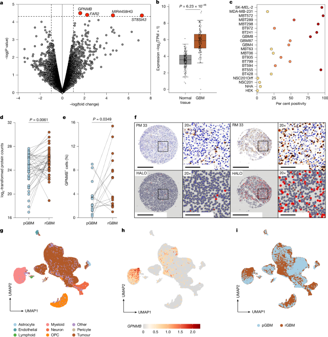 Dual tumour–myeloid targeting of glioblastoma with GPNMB CAR-T cells